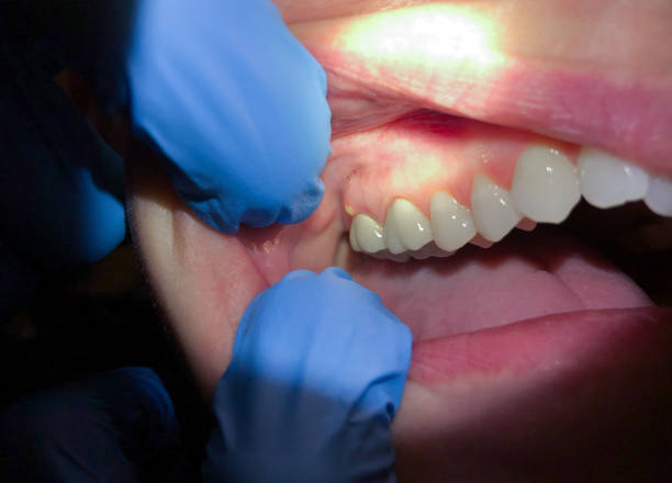Best Emergency Dental Services for Seniors in Congers, NY